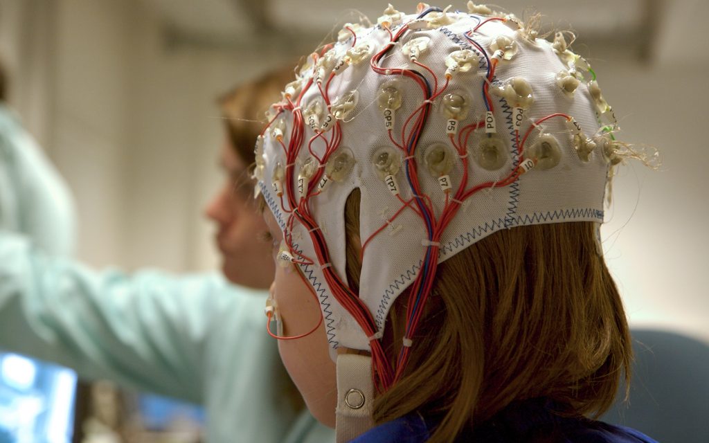 EEG tests can help learn more about epilepsy causes