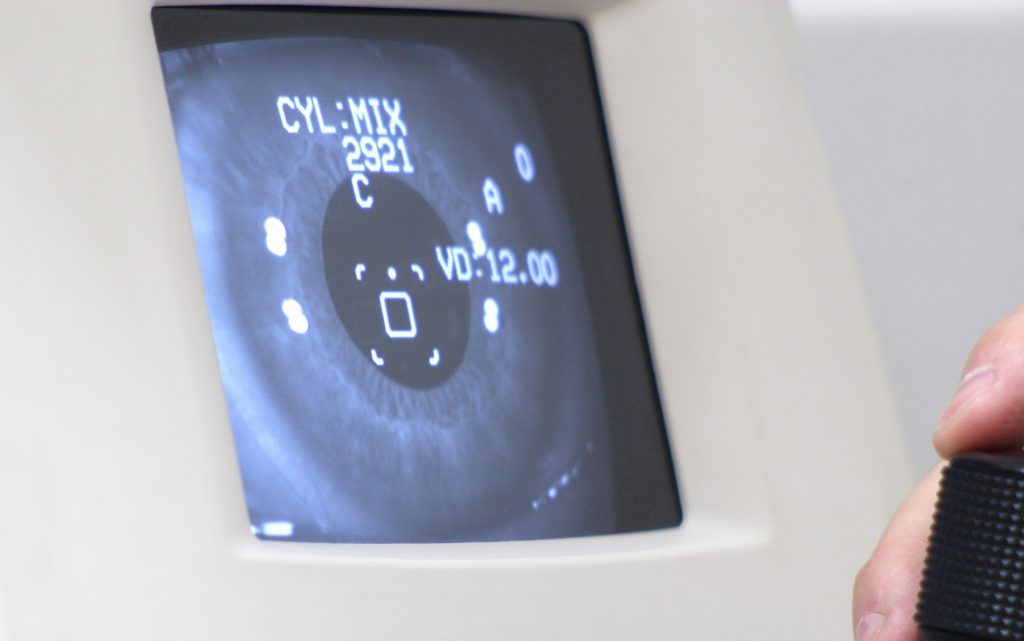 cannabis based treatments for glaucoma